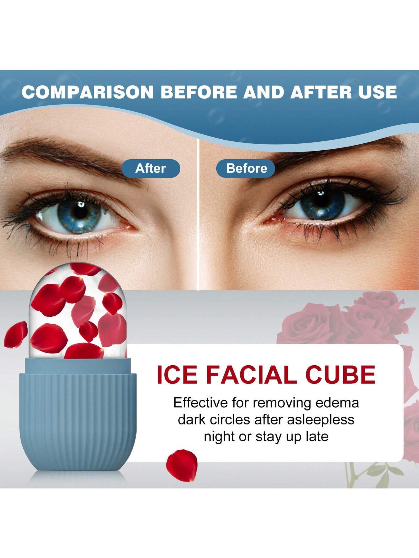 1Pc Striped Facial Ice Roller