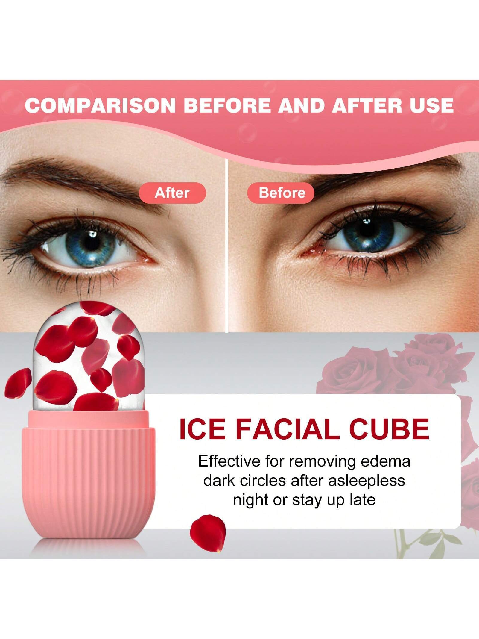 1Pc Striped Facial Ice Roller